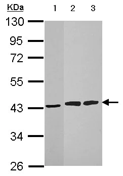Western blot - Anti-HIBCH antibody (AB153826)