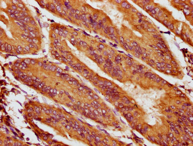 Immunohistochemistry (Formalin/PFA-fixed paraffin-embedded sections) - Anti-HIC1 antibody (AB235037)