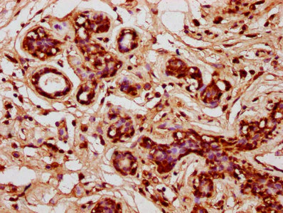 Immunohistochemistry (Formalin/PFA-fixed paraffin-embedded sections) - Anti-HIC1 antibody (AB235037)