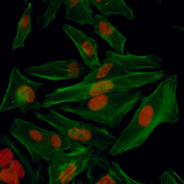 Immunocytochemistry - Anti-HIF-1 alpha antibody (AB114977)