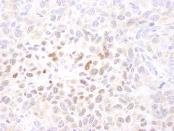 Immunohistochemistry (Formalin/PFA-fixed paraffin-embedded sections) - Anti-HIF-1 alpha antibody (AB114977)