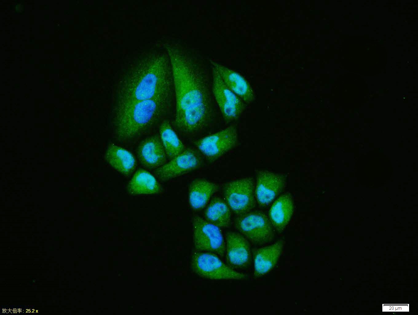 Immunocytochemistry/ Immunofluorescence - Anti-HIF-1 alpha antibody (AB216842), expandable thumbnail