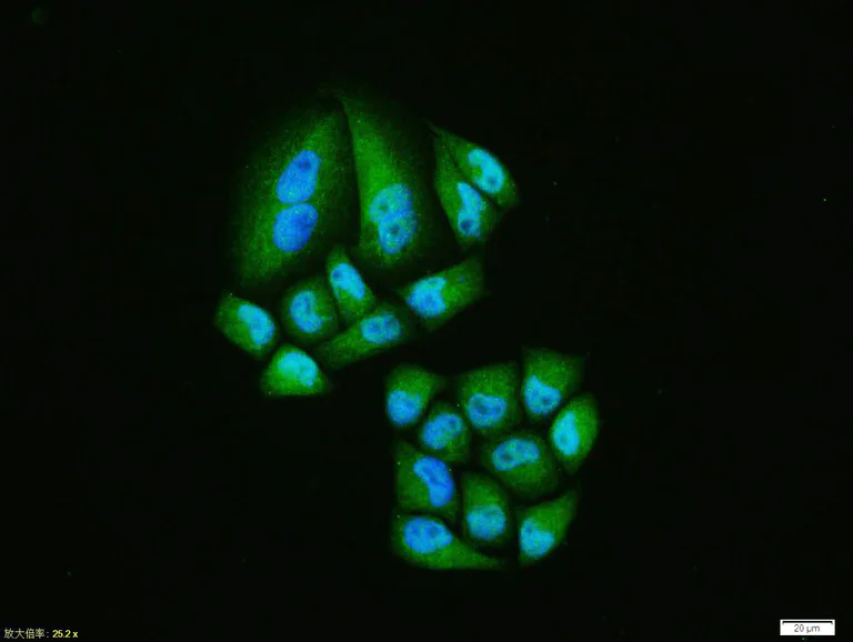 Immunocytochemistry/ Immunofluorescence - Anti-HIF-1 alpha antibody (AB216842)