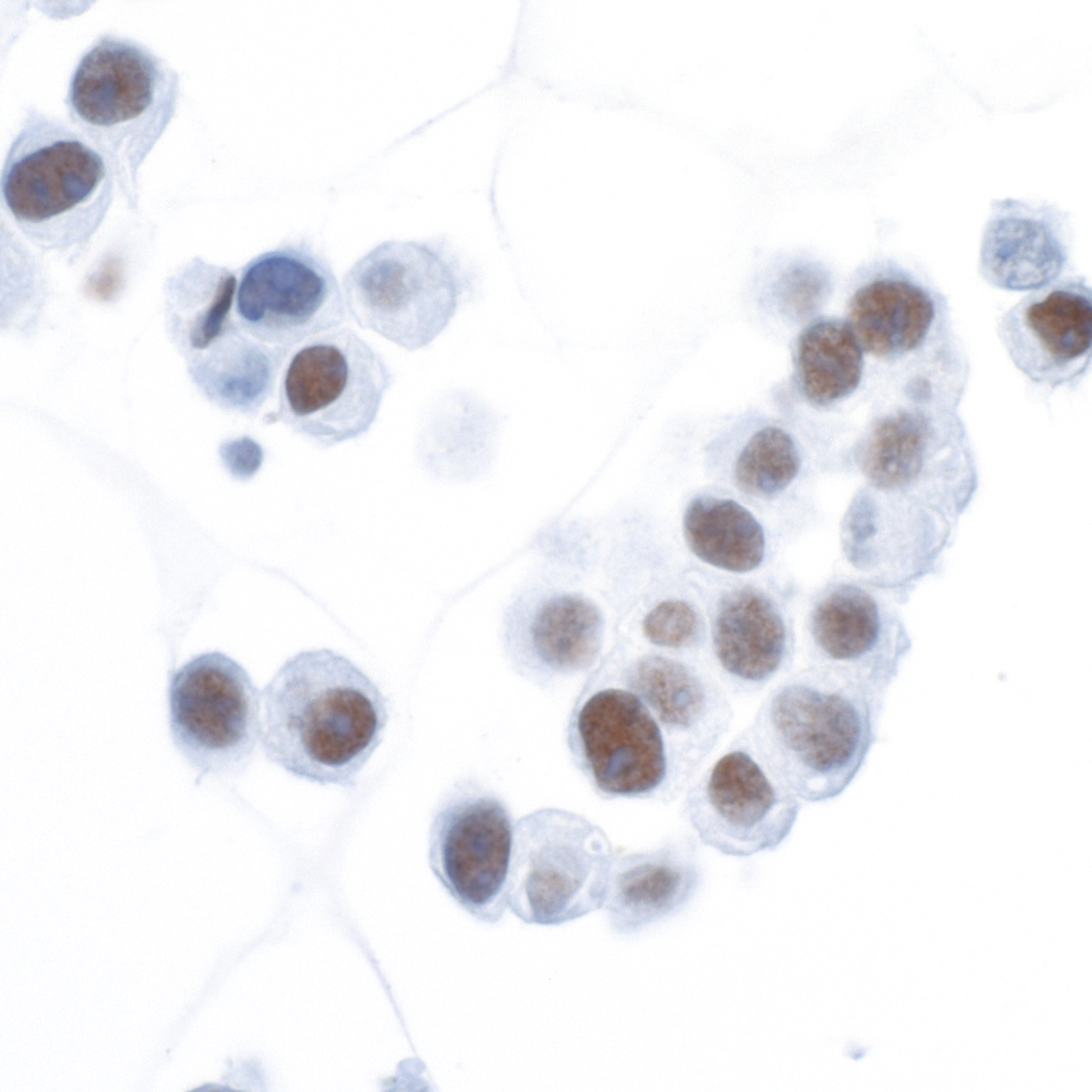 Immunocytochemistry - Anti-HIF-1 alpha antibody [BL-124-3F7] (ab243860), expandable thumbnail