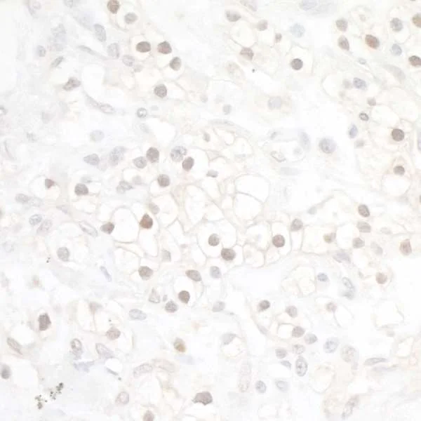 Immunohistochemistry (Formalin/PFA-fixed paraffin-embedded sections) - Anti-HIF-1 alpha antibody [BL-124-3F7] (AB243860)
