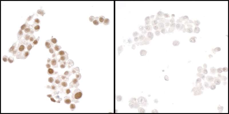 Immunocytochemistry - Anti-HIF-1 alpha antibody [BL-124-3F7] - BSA free (AB272040), expandable thumbnail
