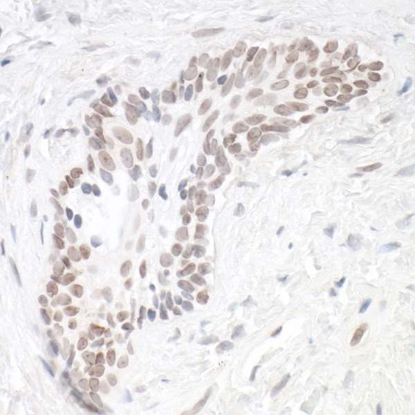 Immunohistochemistry (Formalin/PFA-fixed paraffin-embedded sections) - Anti-HIF-1 alpha antibody [BL-124-3F7] - BSA free (AB272040), expandable thumbnail