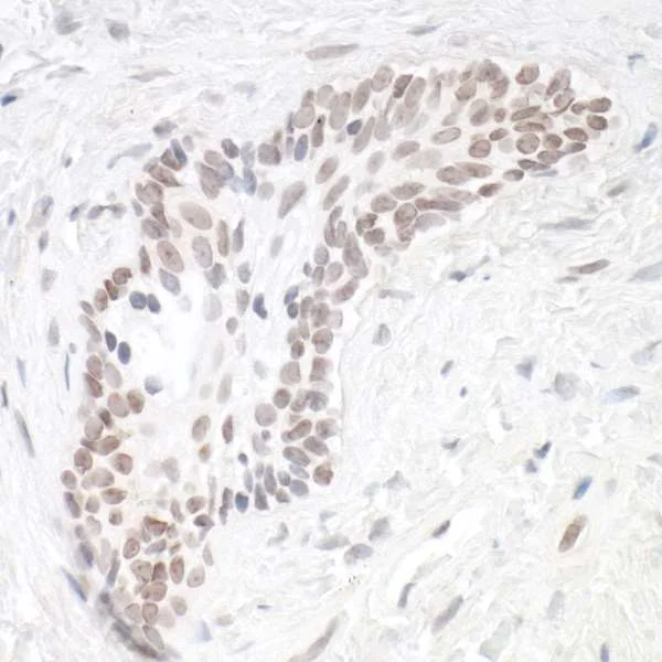 Immunohistochemistry (Formalin/PFA-fixed paraffin-embedded sections) - Anti-HIF-1 alpha antibody [BL-124-3F7] - BSA free (AB272040)