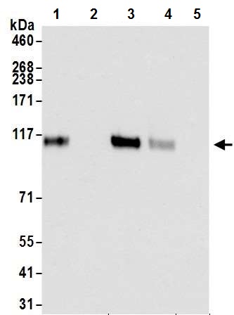 Immunoprecipitation - Anti-HIF-1 alpha antibody [BL-124-3F7] - BSA free (AB272040), expandable thumbnail