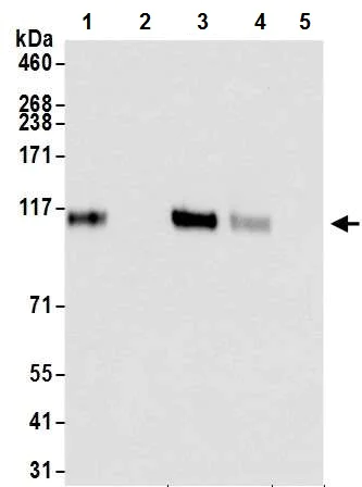 Immunoprecipitation - Anti-HIF-1 alpha antibody [BL-124-3F7] - BSA free (AB272040)