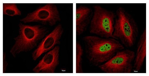 Immunocytochemistry/ Immunofluorescence - Anti-HIF-1 alpha antibody - C-terminal (ab228649), expandable thumbnail