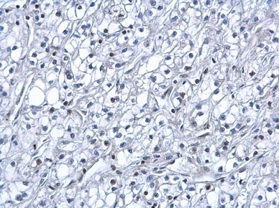 Immunohistochemistry (Formalin/PFA-fixed paraffin-embedded sections) - Anti-HIF-1 alpha antibody - C-terminal (ab228649), expandable thumbnail