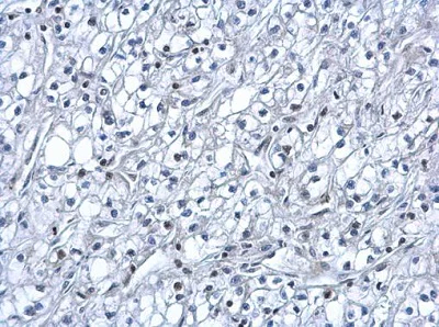 Immunohistochemistry (Formalin/PFA-fixed paraffin-embedded sections) - Anti-HIF-1 alpha antibody - C-terminal (AB228649)