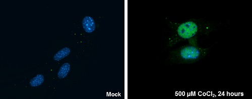Immunohistochemistry (Formalin/PFA-fixed paraffin-embedded sections) - Anti-HIF-1 alpha antibody - C-terminal (ab228649), expandable thumbnail