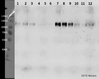 Western blot - Anti-HIF-1 alpha antibody [EP1215Y] (AB51608)