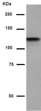 Western blot - Anti-HIF-1 alpha antibody [EP1215Y] (AB51608)