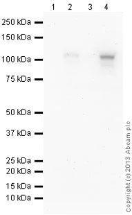Western blot - Anti-HIF-1 alpha antibody [EP1215Y] (AB51608)