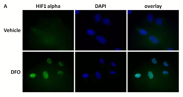Immunocytochemistry/ Immunofluorescence - Anti-HIF-1 alpha antibody [EP1215Y] - BSA and Azide free (AB210073)