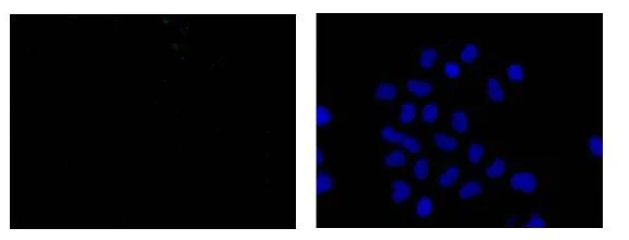 Immunocytochemistry/ Immunofluorescence - Anti-HIF-1 alpha antibody [EP1215Y] - BSA and Azide free (AB210073)
