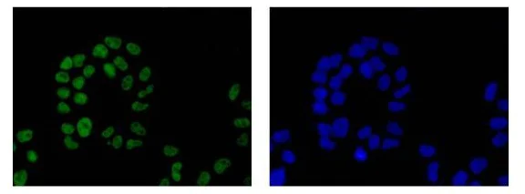 Immunocytochemistry/ Immunofluorescence - Anti-HIF-1 alpha antibody [EP1215Y] - BSA and Azide free (AB210073)