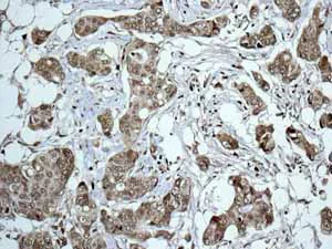 Immunohistochemistry (Formalin/PFA-fixed paraffin-embedded sections) - Anti-HIF-1 alpha antibody [EP1215Y] - BSA and Azide free (AB210073)