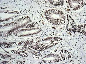 Immunohistochemistry (Formalin/PFA-fixed paraffin-embedded sections) - Anti-HIF-1 alpha antibody [EP1215Y] - BSA and Azide free (AB210073)