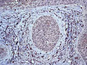 Immunohistochemistry (Formalin/PFA-fixed paraffin-embedded sections) - Anti-HIF-1 alpha antibody [EP1215Y] - BSA and Azide free (AB210073)