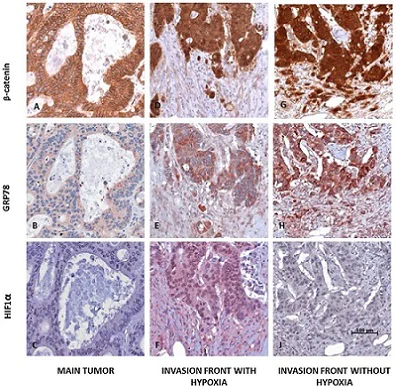 Immunohistochemistry (Formalin/PFA-fixed paraffin-embedded sections) - Anti-HIF-1 alpha antibody [EP1215Y] - BSA and Azide free (AB210073)