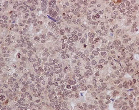 Immunohistochemistry (Formalin/PFA-fixed paraffin-embedded sections) - Anti-HIF-1 alpha antibody [EP1215Y] - BSA and Azide free (AB210073)