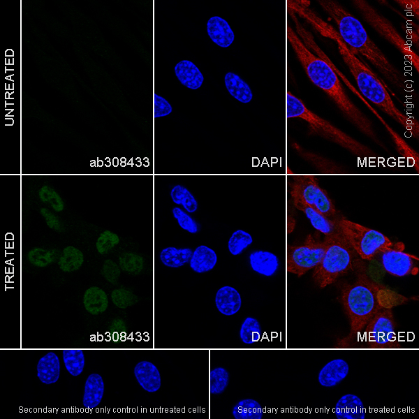 Immunocytochemistry/ Immunofluorescence - Anti-HIF-1 alpha antibody [EPR16897-145] (ab308433), expandable thumbnail