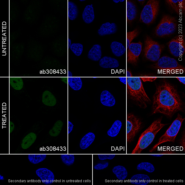 Immunocytochemistry/ Immunofluorescence - Anti-HIF-1 alpha antibody [EPR16897-145] (ab308433), expandable thumbnail