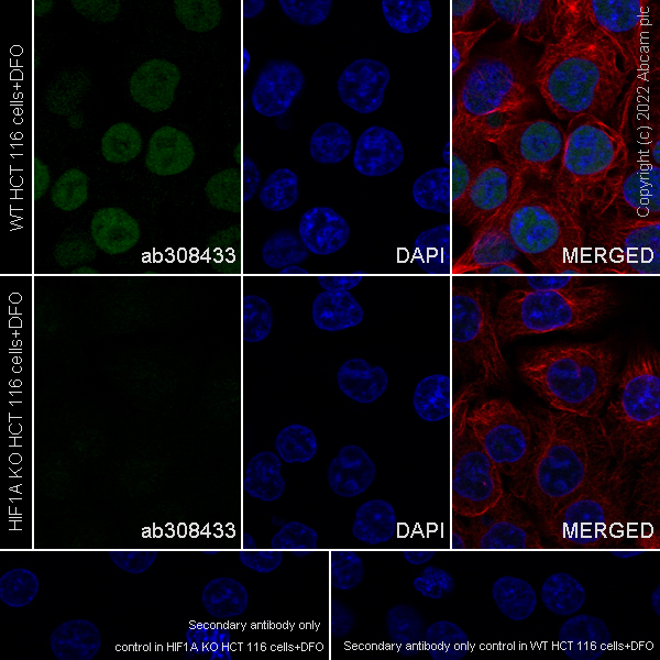 Immunocytochemistry/ Immunofluorescence - Anti-HIF-1 alpha antibody [EPR16897-145] (ab308433), expandable thumbnail