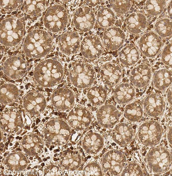 Immunohistochemistry (Formalin/PFA-fixed paraffin-embedded sections) - Anti-HIF-1 alpha antibody [ESEE122] (AB8366), expandable thumbnail