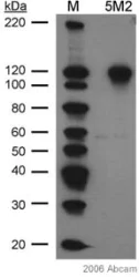 Western blot - Anti-HIF-1 alpha antibody [H1alpha67] (AB1)