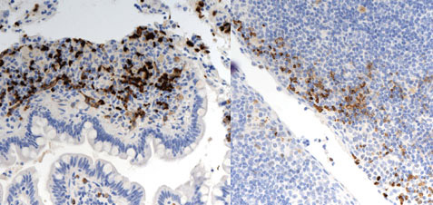 Immunohistochemistry (Formalin/PFA-fixed paraffin-embedded sections) - Anti-HIF-1 alpha antibody [mgc3] (AB16066), expandable thumbnail