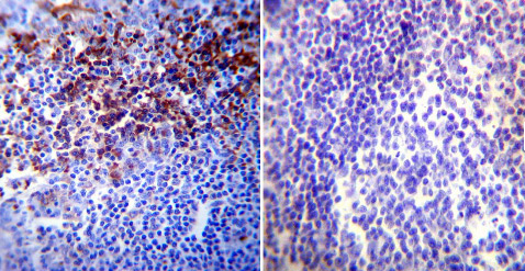 Immunohistochemistry (Formalin/PFA-fixed paraffin-embedded sections) - Anti-HIF-1 alpha antibody [mgc3] (AB16066), expandable thumbnail