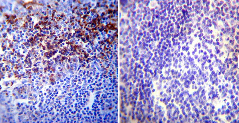 Immunohistochemistry (Formalin/PFA-fixed paraffin-embedded sections) - Anti-HIF-1 alpha antibody [mgc3] (AB16066)