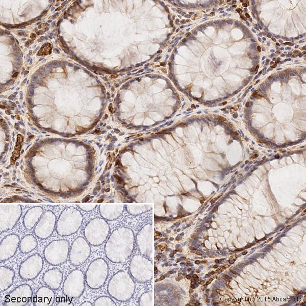 Immunohistochemistry (Formalin/PFA-fixed paraffin-embedded sections) - Anti-HIF-1 alpha antibody [mgc3] (AB16066), expandable thumbnail