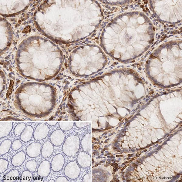 Immunohistochemistry (Formalin/PFA-fixed paraffin-embedded sections) - Anti-HIF-1 alpha antibody [mgc3] (AB16066)