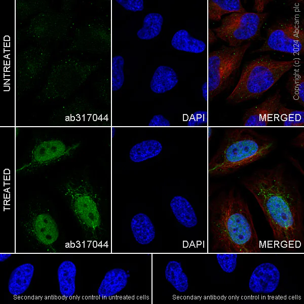 Immunocytochemistry/ Immunofluorescence - Anti-HIF-1 alpha antibody [RM1116] (AB317044)