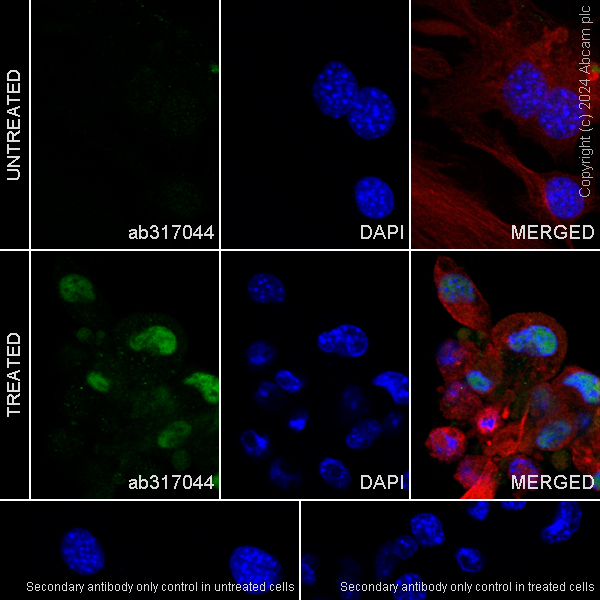 Immunocytochemistry/ Immunofluorescence - Anti-HIF-1 alpha antibody [RM1116] - BSA and Azide free (ab317045), expandable thumbnail