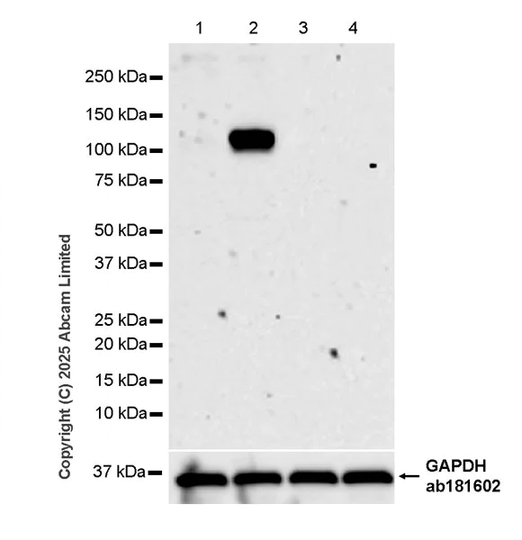 Western blot - Anti-HIF-1 alpha antibody [SIMA343B] (AB325355)
