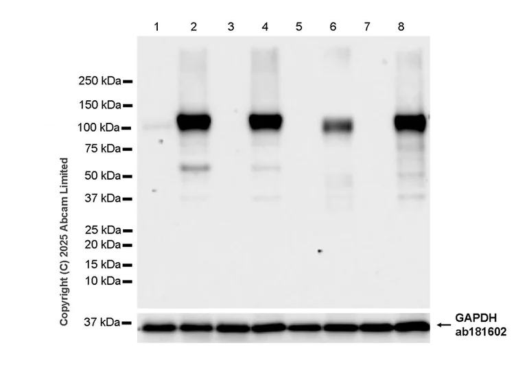 Western blot - Anti-HIF-1 alpha antibody [SIMA343B] (AB325355)