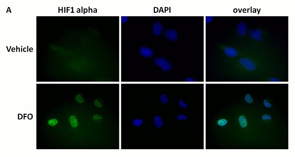 Immunocytochemistry/ Immunofluorescence - HIF-1 alpha (H1alpha67, EP1215Y, ESEE122, EPR16897) Antibody Panel (ab263460), expandable thumbnail