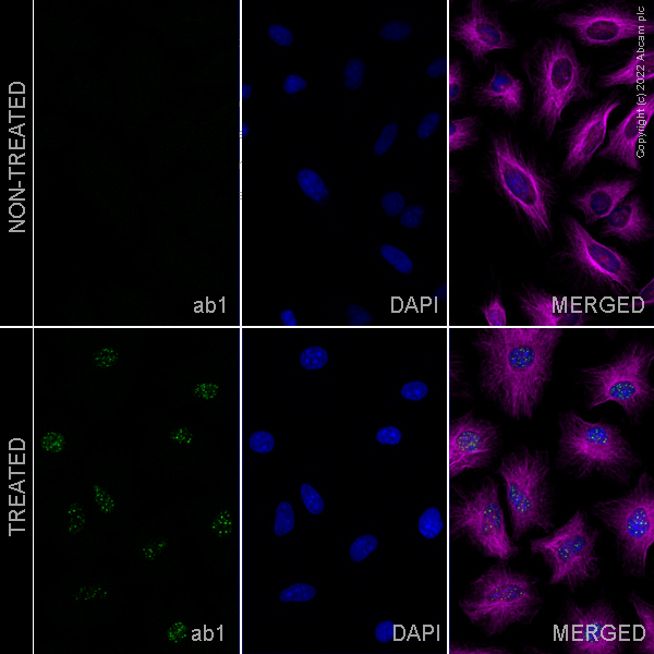 Immunocytochemistry/ Immunofluorescence - HIF-1 alpha (H1alpha67, EP1215Y, ESEE122, EPR16897) Antibody Panel (ab263460), expandable thumbnail
