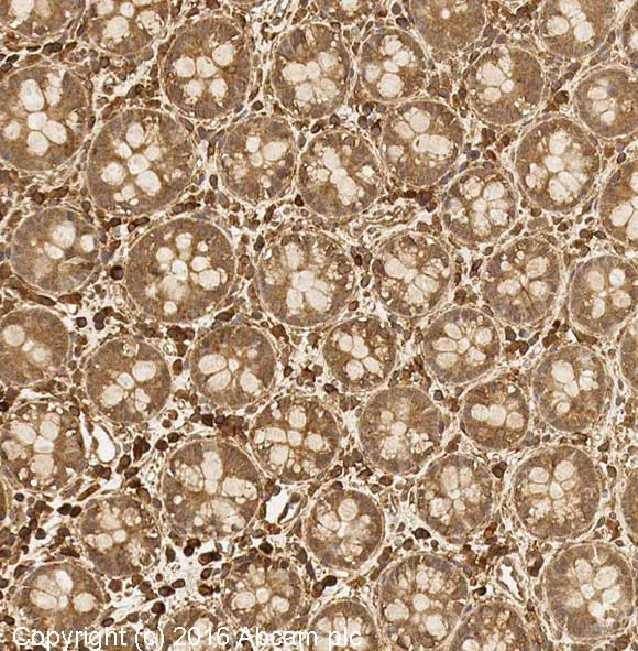 Immunohistochemistry (Formalin/PFA-fixed paraffin-embedded sections) - HIF-1 alpha (H1alpha67, EP1215Y, ESEE122, EPR16897) Antibody Panel (AB263460)