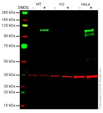 Western blot - HIF-1 alpha (H1alpha67, EP1215Y, ESEE122, EPR16897) Antibody Panel (AB263460)
