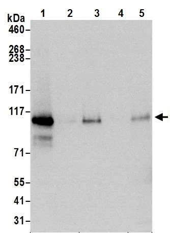Western blot - Anti-HIF-2-alpha antibody [BL-95-1A2] (AB243861)