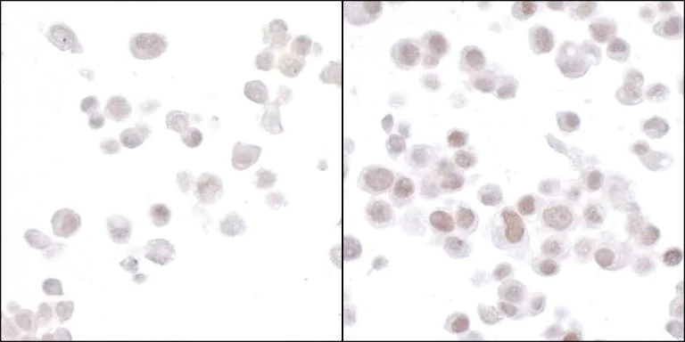 Immunocytochemistry - Anti-HIF-2-alpha antibody [BL-95-1A2] - BSA free (AB272041)