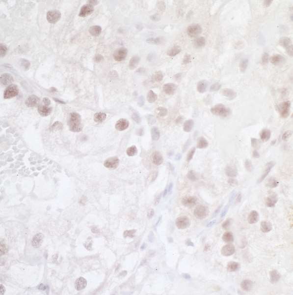 Immunohistochemistry (Formalin/PFA-fixed paraffin-embedded sections) - Anti-HIF-2-alpha antibody [BL-95-1A2] - BSA free (AB272041)